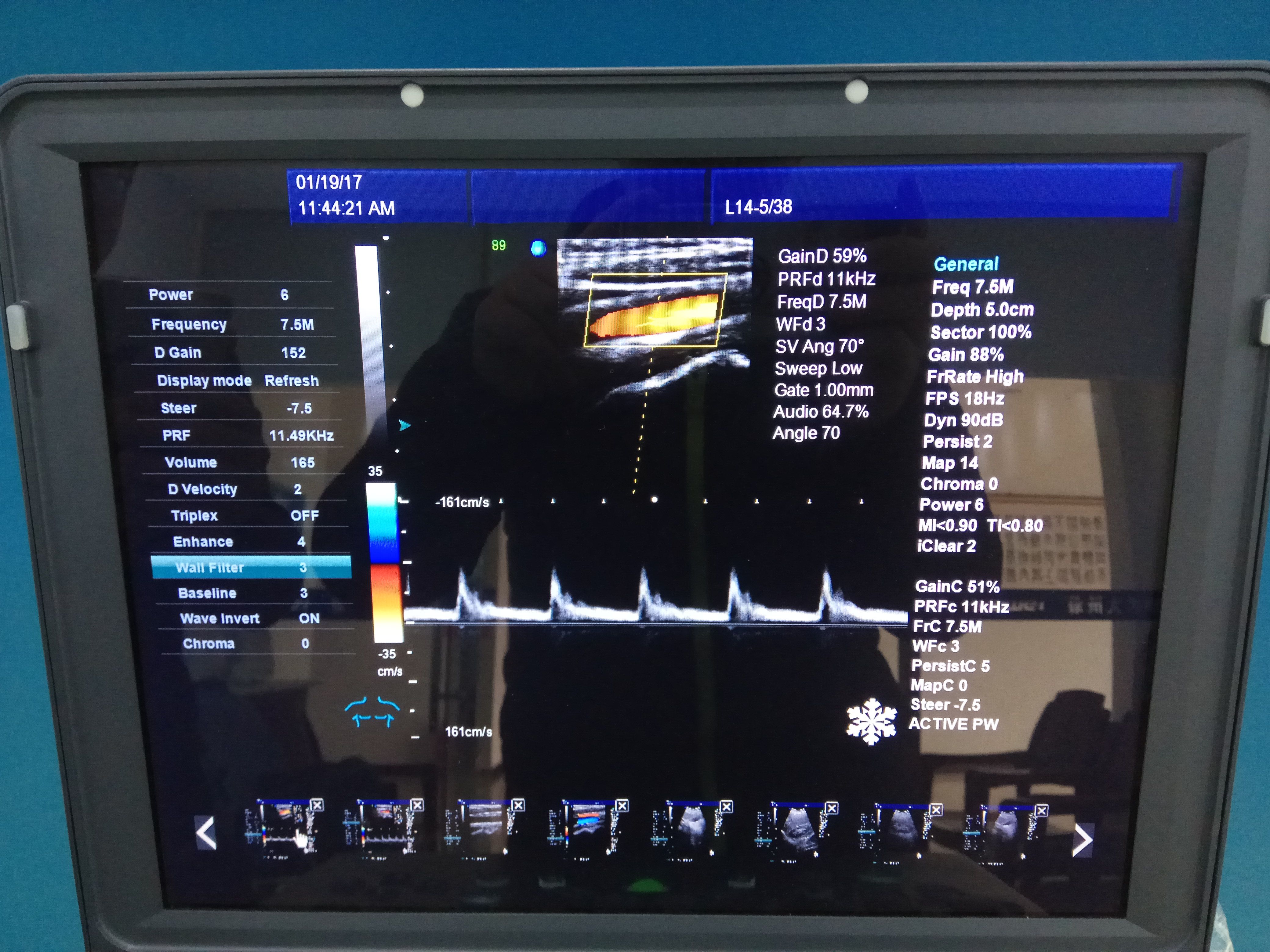 Mobile harmonica equipment human 3D color doppler  ultrasound machine