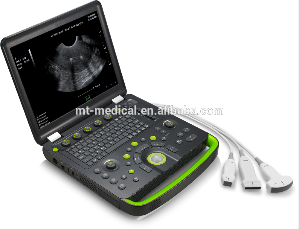 Digital Portable 4 3d laptop USG Color Doppler Ultrasound Scanner with Double Two Sockets