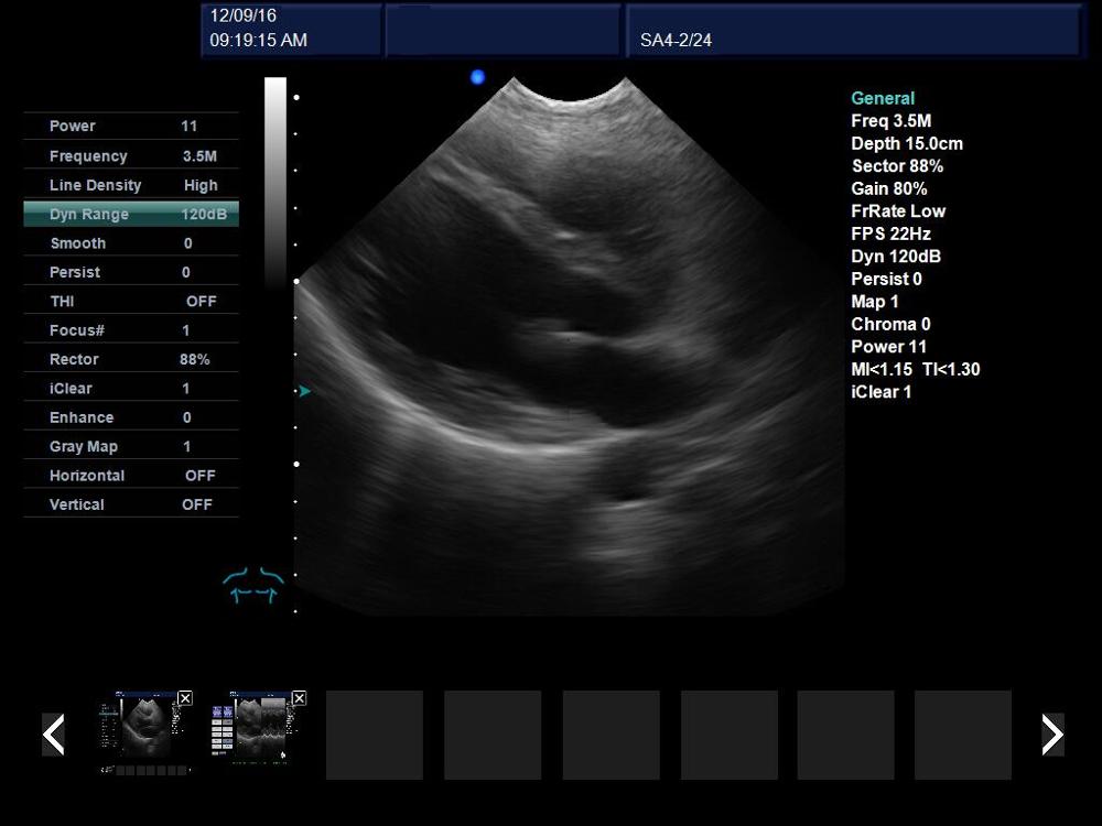 Portable continuous doppler cardiac inspection 3d 4d echocardiograph
