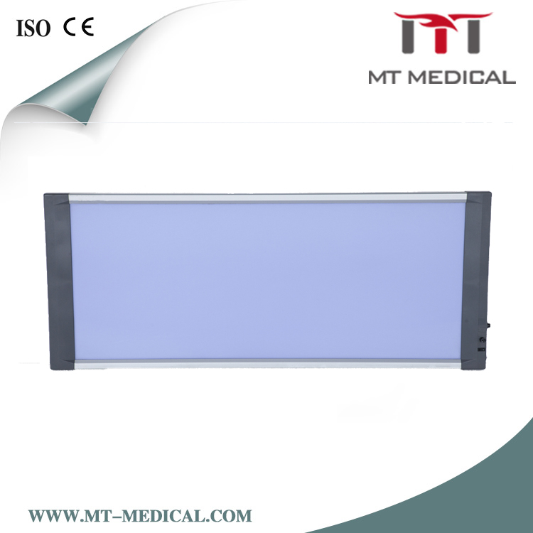 Hospital medical film viewer x ray viewer led x-ray viewing box x-ray viewing light box