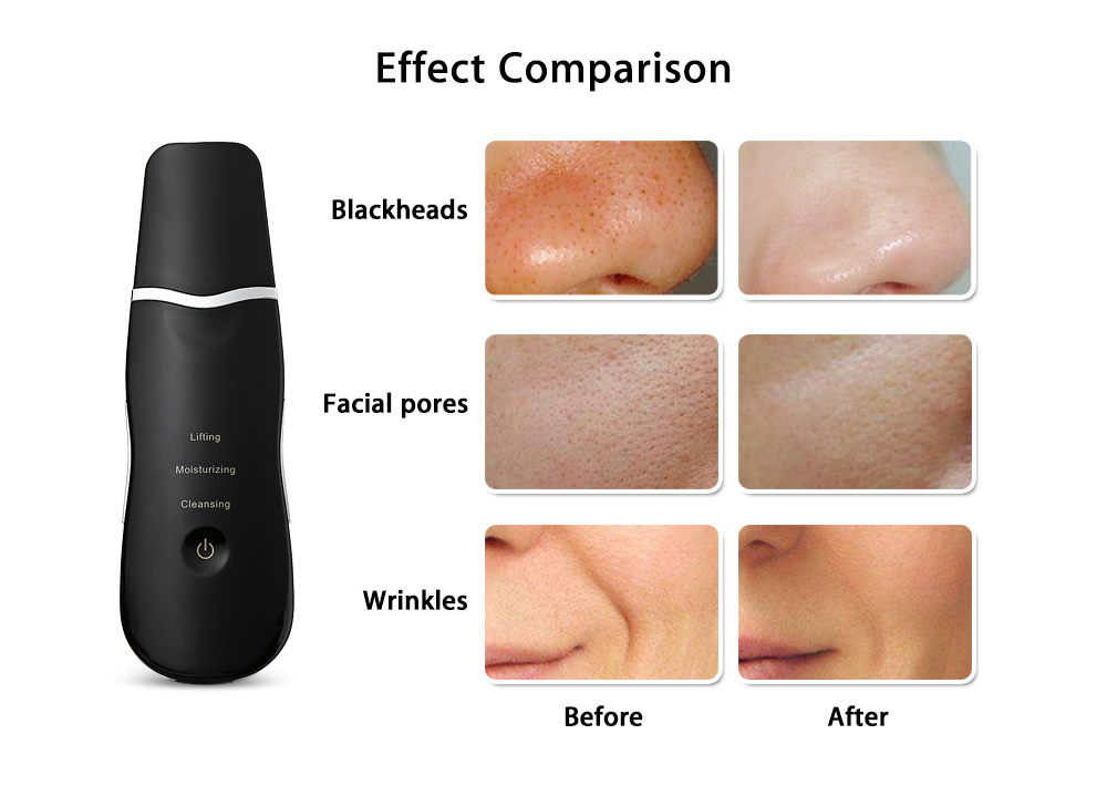 Rechargeable Ultrasonic Face Skin Scrubber Facial Cleaner Peeling Vibration Blackhead Removal Exfoliating Pore Cleaner Tools