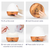 China Factory Essential Oil Aroma Diffuser, Private Label Essential Oil Diffuser, Aromatherapy Essential Oil Diffuser Ultrasonic