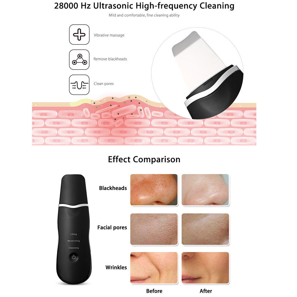 New 2018 Rechargeable Ultrasonic Face Skin Scrubber  Vibration facial  Exfoliating Pore Cleaner Tools ultrasonic photon facial m