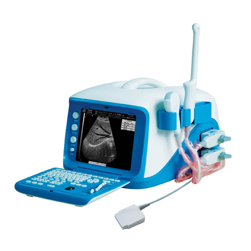 China Hospital and Medical Equipment Full Digital Portable Ultrasound Scanner KZ-6000 Price