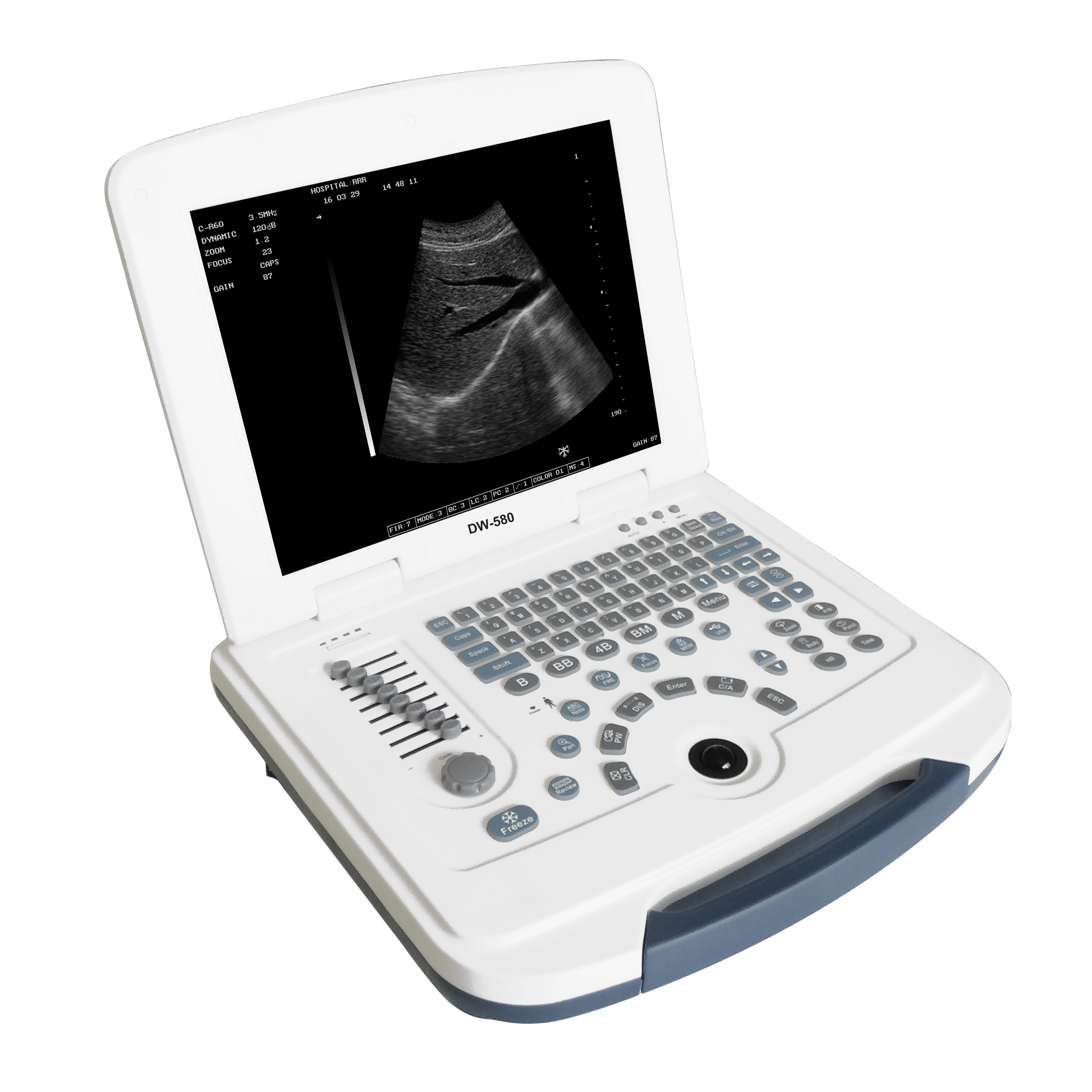 Full-digital Laptop Ultrasound Scanner