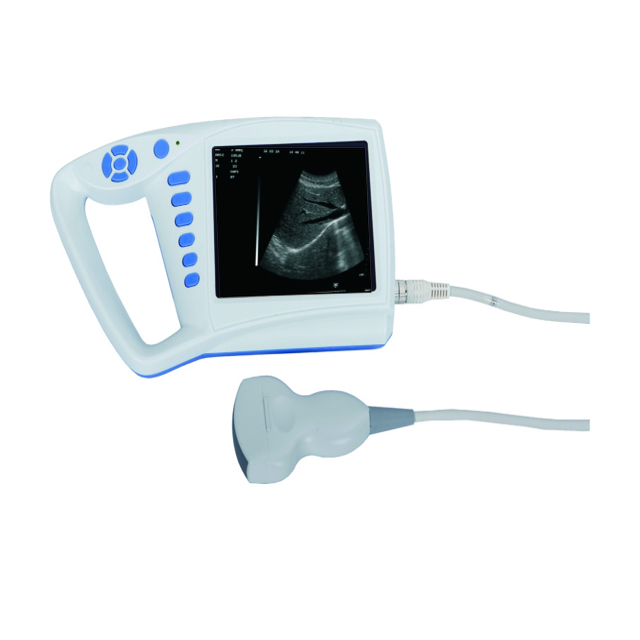 Full Digital Palm Ultrasound Scanner Machine China USS-353C