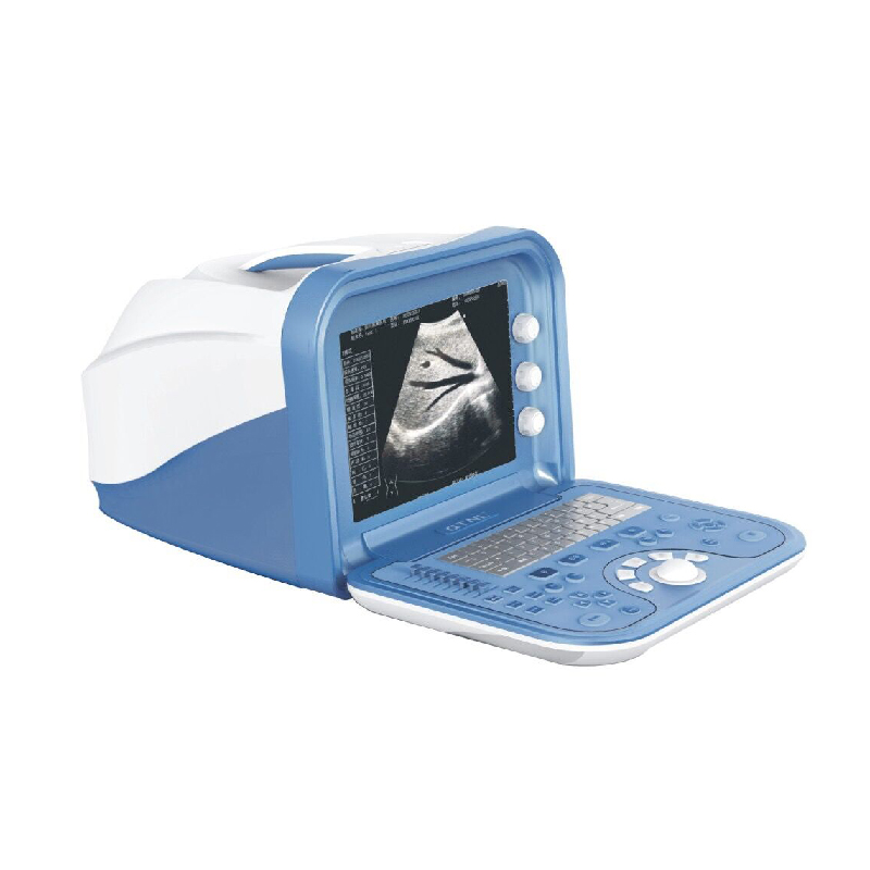 Portable ultrasound
