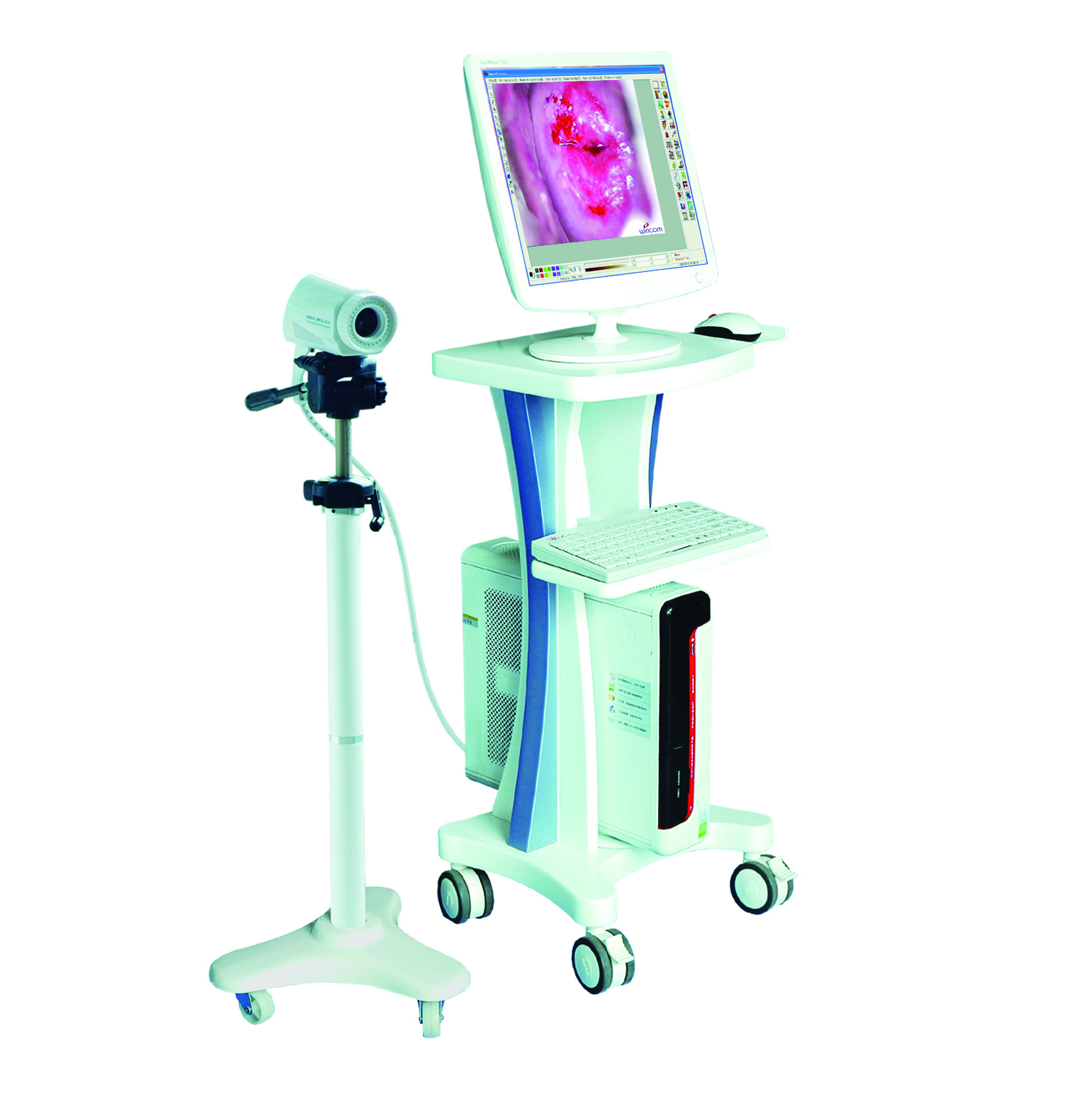 Coslposcopy
