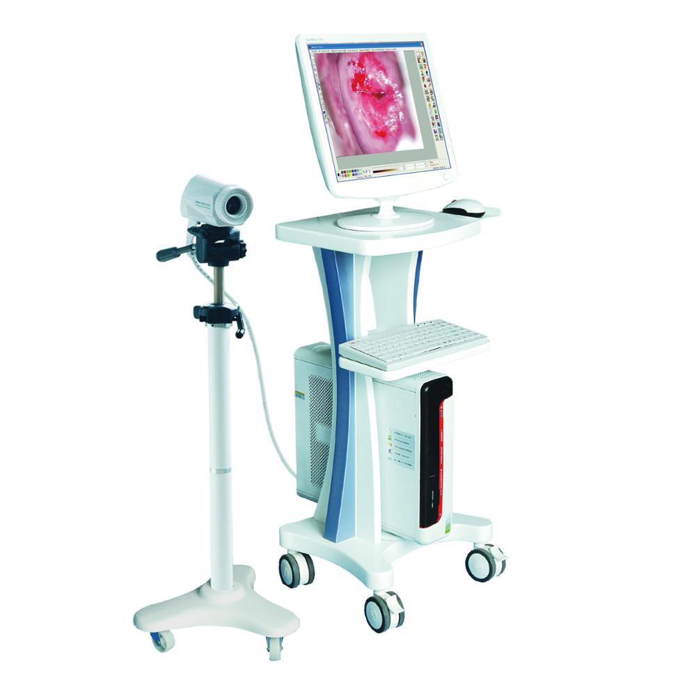 Medical Equipment Digital Electronic Colposcope LA-2001I Price