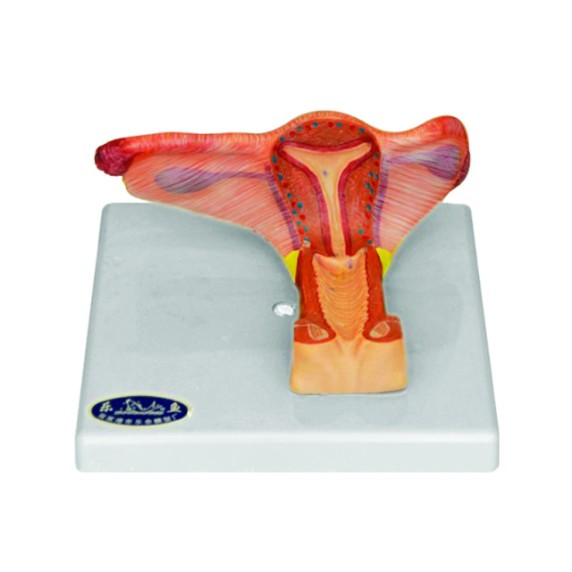 Kidney model, plastic model