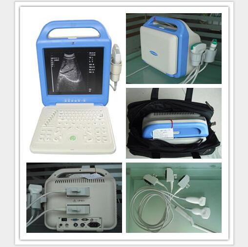 Medical Equipment Digital Laptop Ultrasound Scanner With 12 Inch LCD Monitor