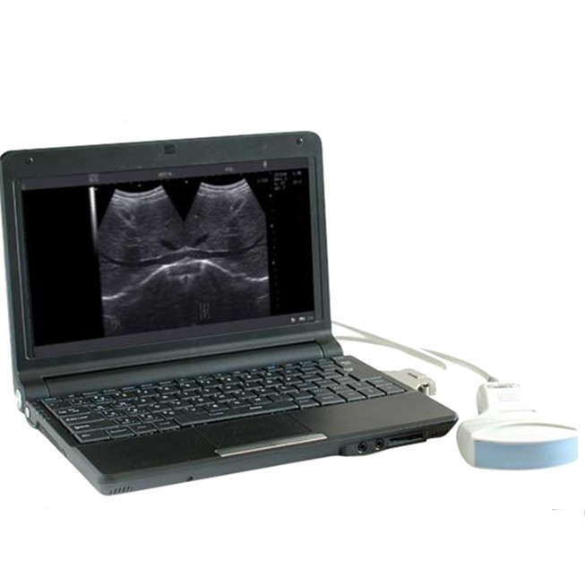 portable PC Notebook digital diagnostic ultrasound scanner WT-6000B