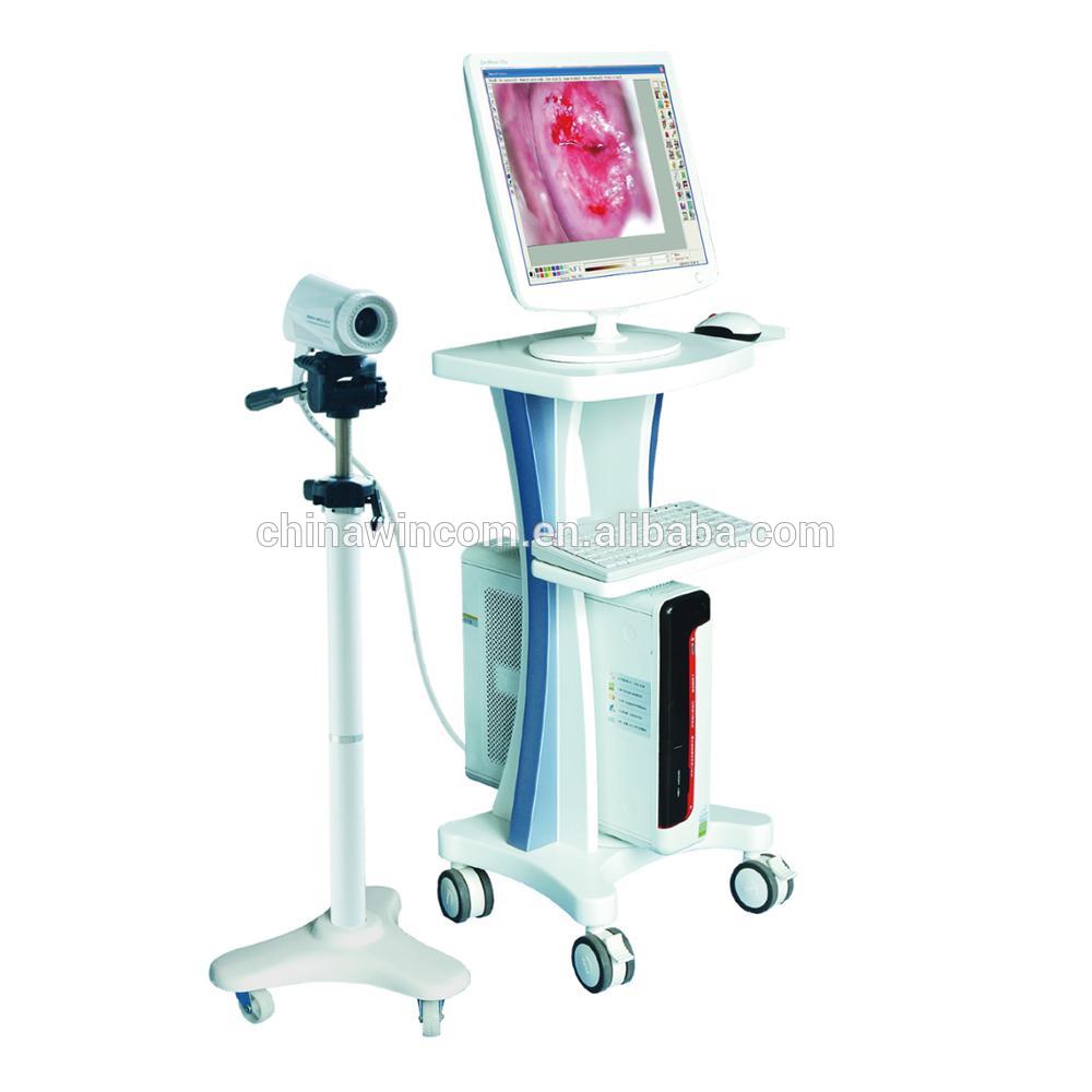 Portable Electronic Digital Imaging Colposcope for Vagina Treatment