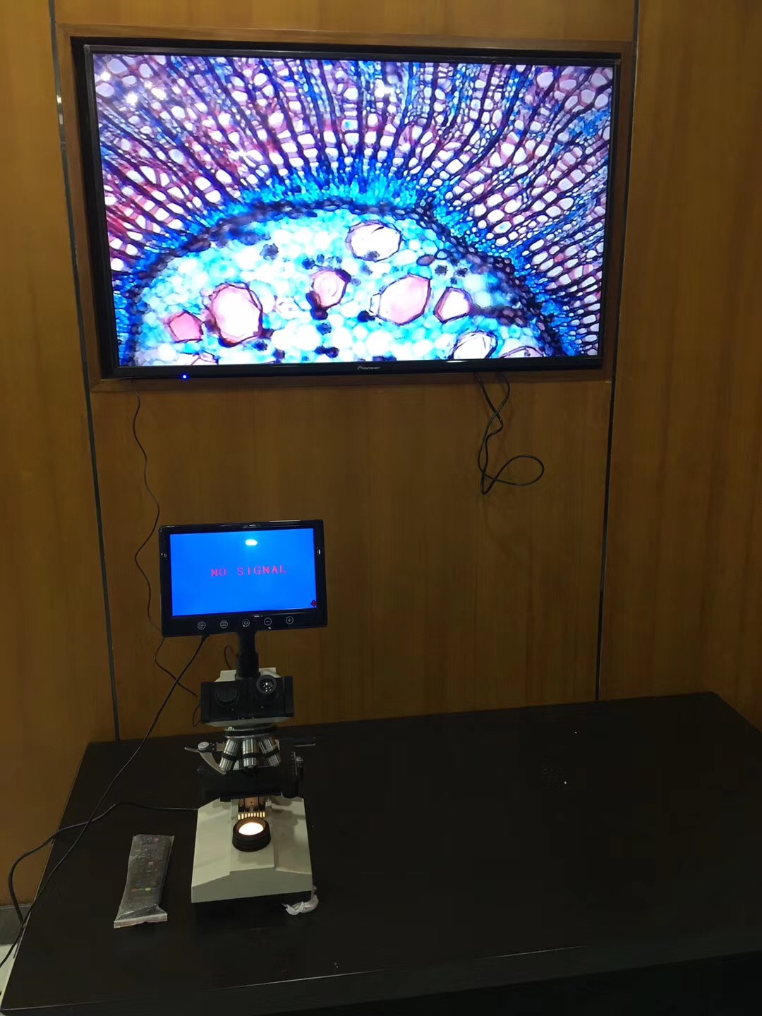 Best Seller Trinocular Biological Microscope With Screen,connect to PC and TV