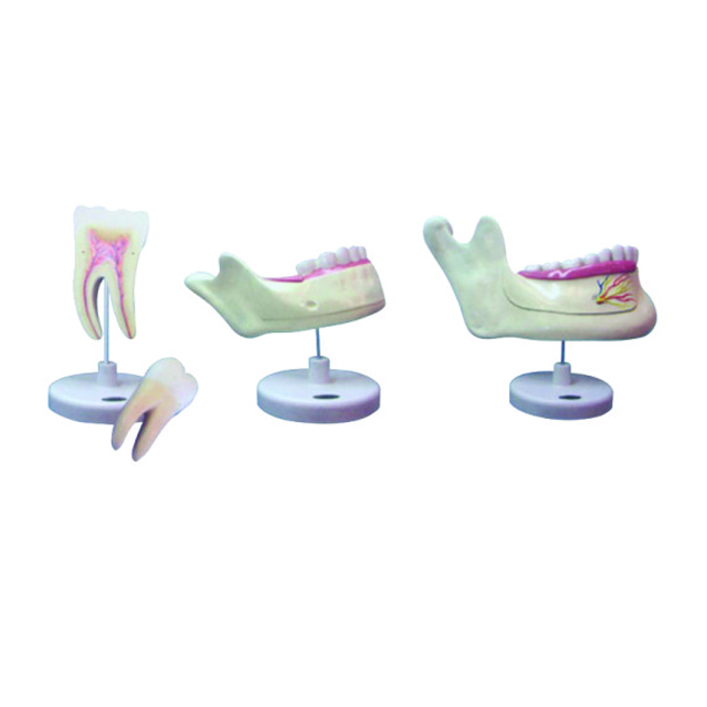 Dental Dentes Model Study