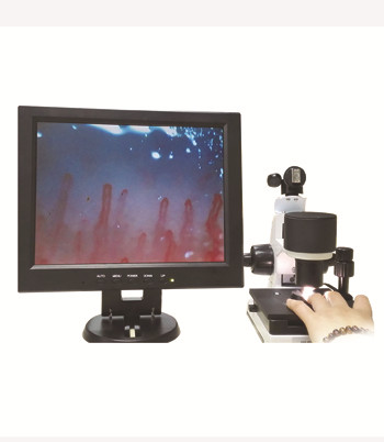 Nailfold Video Capillaroscope Detection Instrument Blood Capillary Microcirculation Microscope